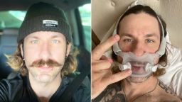 Six months after contracting Covid-19, fitness consultant Corey Coopersmith now uses a CPAP machine to help push enough air into his lungs.